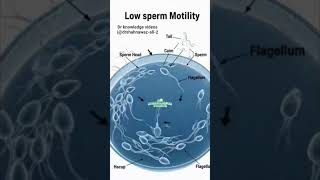 low #sperm motility #details