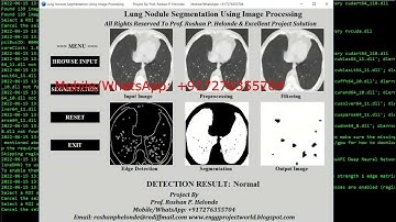 Lung Nodule Identification Using Image Processing With Source Code Python Tensorflow OpenCv Project