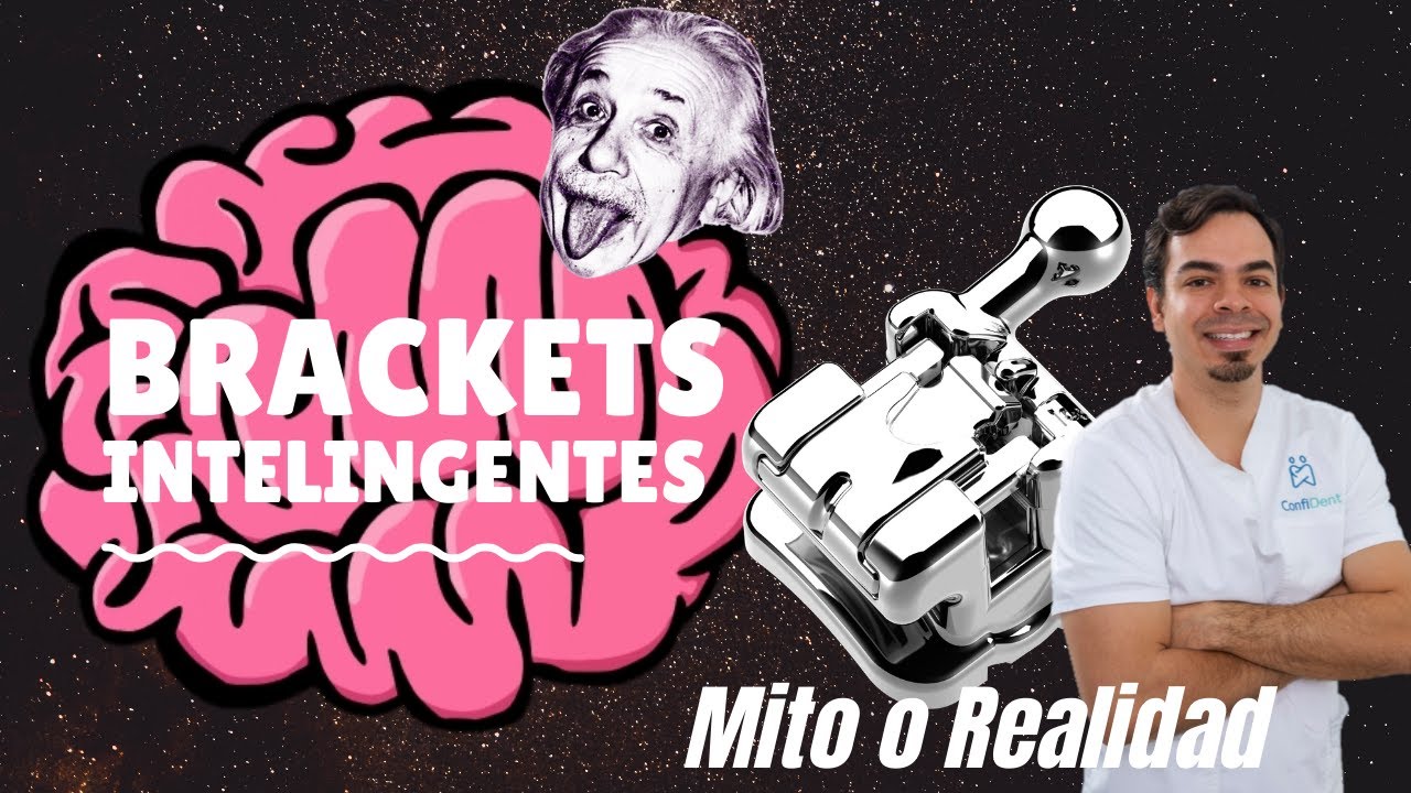 Brackets inteligentes de autoligado, ¿los dientes se enderezan solos