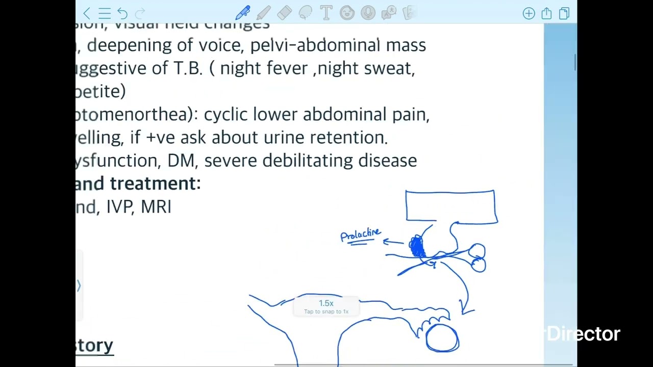 History taking (primary amenorrhea)