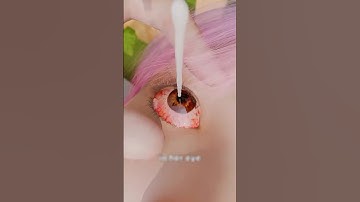 What REALLY Happens If Super Glue Gets in Your Eye (And What You MUST Do Fast)!?😁