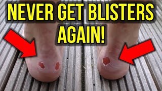 THE SECRET TO NEVER GETTING BLISTERS FROM YOUR FOOTBALL BOOTS!