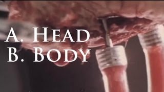 The Midnight Archive - A. Head B. Body