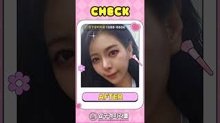 [리프팅] 실리프팅 받고 외모췌엑! #실리프팅전후 #시술후기 #성형후기 #안면거상 #shorts #메이크업 #beauty  #ショート動画 #치킨바나나