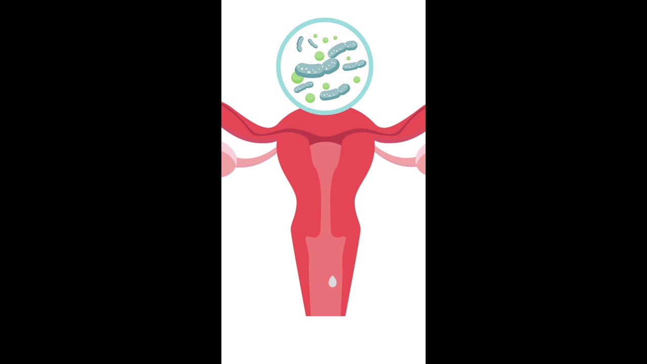 BV Vs Yeast Infection How To Tell The Difference