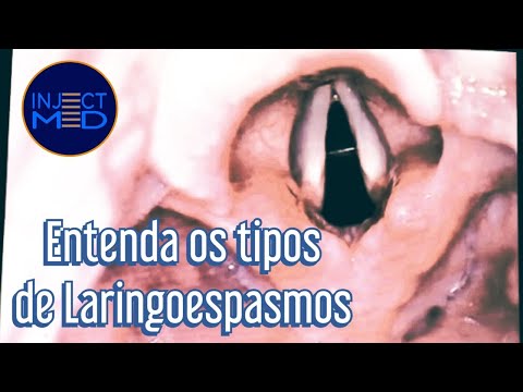 Vídeo: Diferença Entre Broncoespasmos E Laringoespasmos