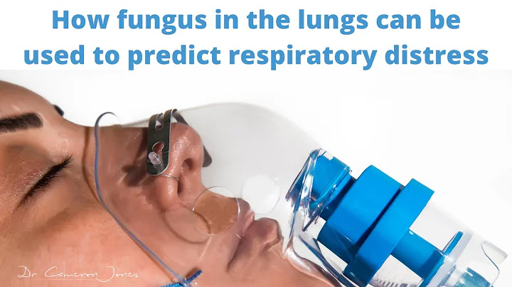 How fungus in the lungs can be used to predict respiratory distress