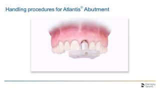 Atlantis Insertion Guide