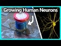 Growing Human Neurons Hooked Up To Electrodes