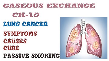 lung cancer | SYMPTOMS | CAUSES | CURE | 10TH CLASS | BIOLOGY | CHAPTER NO 10 l bio with ayesha