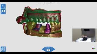 Progetto di emiarcata con monconi con Optor Lab: modulo opzionale Concept Quad