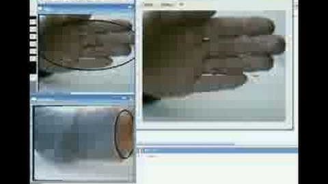 Occlusion