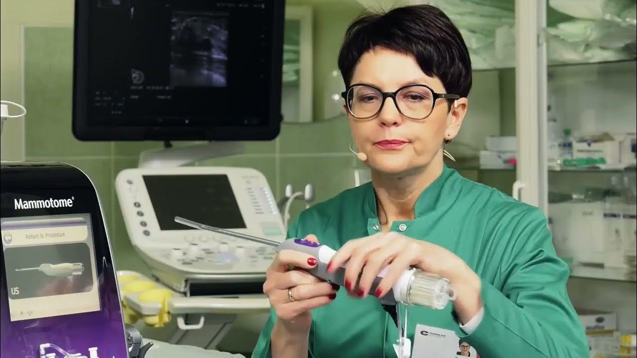 Mammotome Revolve U/S Breast Biopsy Procedure YouTube