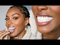 MY INVISALIGN JOURNEY | PART 1: How much it costs? Does it hurt? Getting Started? | Slim Reshae