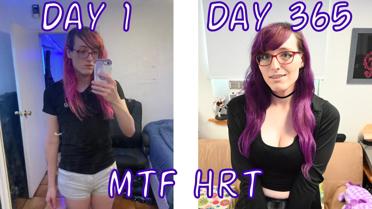 Год приема эстрогена ИЗМЕНИЛ МОЮ ЖИЗНЬ (трансгендерная женщина, ЗГТ)