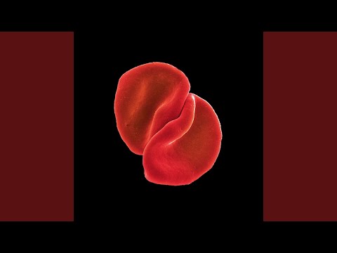 My Body Is A Cage (Oxford London Temple Version)
