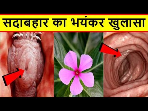 वीडियो: स्वास्थ्य का अमृत - अदरक की जड़