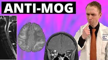 MOGAD (Myelin Oligodendrocyte Glycoprotein Associated Disease) Explained by Neurologist