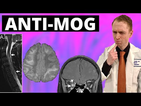 MOGAD Myelin Oligodendrocyte Glycoprotein Associated Disease Explained By Neurologist