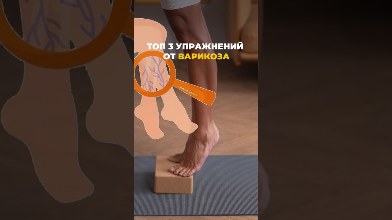 ТОП-4 упражнения от ВАРИКОЗА ✅ #shorts #варикоз #упражнениядляног #тренировки #здоровыестопы
