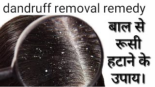 dandruff removal remedy /बाल से रूसी हटाने के उपाय।