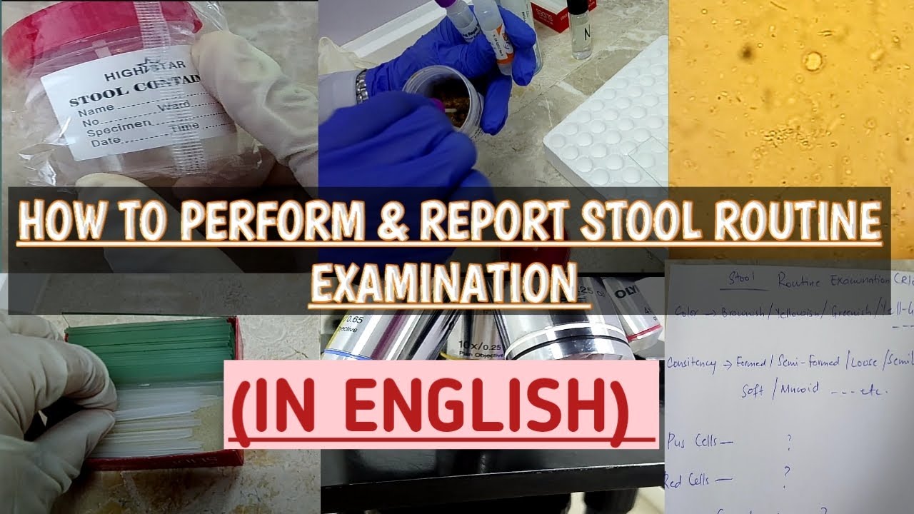 stool-routine-examination-reporting-explained-step-by-step-in-an-easy