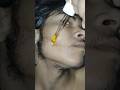 minoxidil kese lagaye| How to use minoxidil #viralshort #minoxidil #beardgrowth