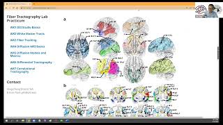 DSI Studio Workshop (Sep 16 2022) Wk2: White Matter Tracts