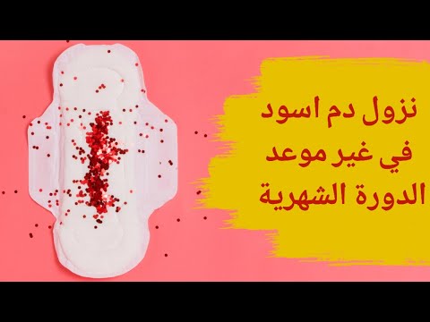 نزول دم اسود في غير موعد الدورة سبب نزول دم اسود في غير موعد الدورة سبب نزول دم اسود من المهبل