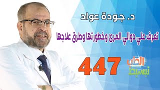 تبسيط الطب (447 ) | تعرف علي دوالي المرئ وخطورتها وطرق علاجها | د . جودة عواد