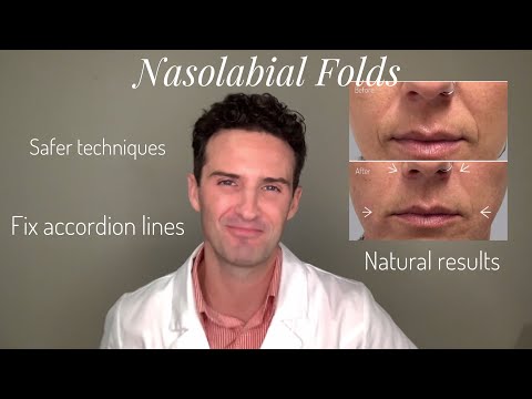 Video: Contour Correction Of Nasolabial Folds