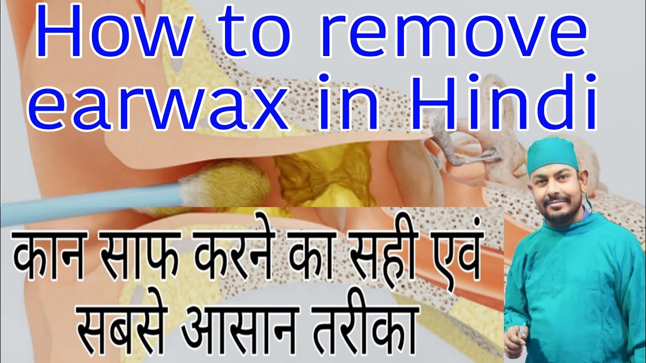 Ear Wax Removal - How To Remove Ear Wax At Home - YouTube
