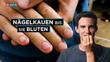 Ist Nägelkauen ein Zwang?