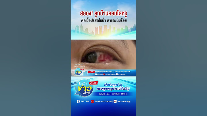 สยอง! ลูกบ้านคอนโดหรู ติดเชื้อปรสิตในน้ำ ตาแดงนับร้อย