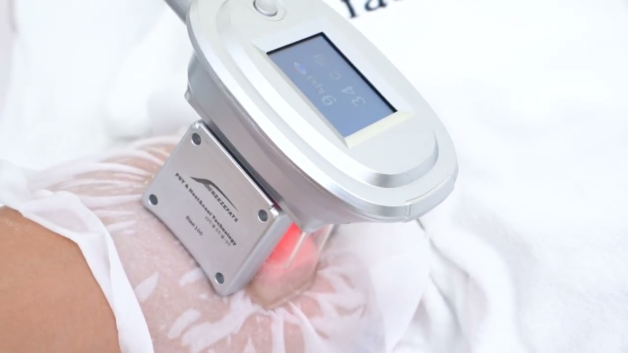 Cryo Cellulite Treatment: Smooth Thighs Ahead