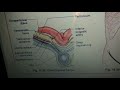 Inguinal Hernia - Anatomy  in easy way