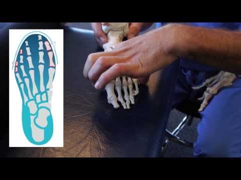 Spread Your Toes™ Series: Sesamoiditis Conservative Care vs. Conventional Care