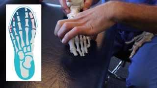 Spread Your Toes™ Series: Sesamoiditis Conservative Care vs. Conventional Care