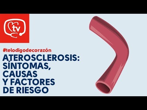 Vídeo: Diferencia Entre Enfermedad De Las Arterias Coronarias Y Aterosclerosis