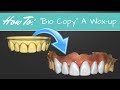 How to "bio copy" a 6 UNIT wax-up in under 20 minutes