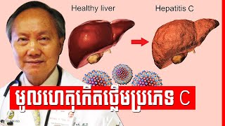ជំងឺថ្លើមប្រភេទសេ C ភាគទី១ ​៖ ការធ្វើរោគវិនិច្ឆ័យ និង គ្រោះថ្នាក់របស់វា , Hepatitis​ C