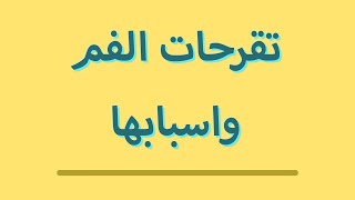 تقرحات الفم ماهي اسبابها