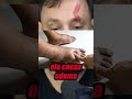O QUE NÃO FAZER QUANDO FOR PICADO POR UMA COBRA #richardrasmussen #biologohenrique #cobra