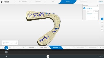 CEREC SW 5 - Digital Chairside Implant Workflow (5/5)