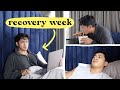Surgery recovery | feeling useless...and hungry