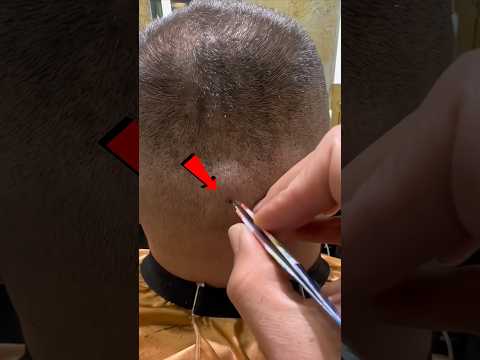 يجب ان تتوقف عن حلاقة القزع فورا