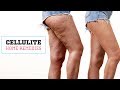 How To Get Rid Of Cellulite Naturally | Glamrs Skin Care