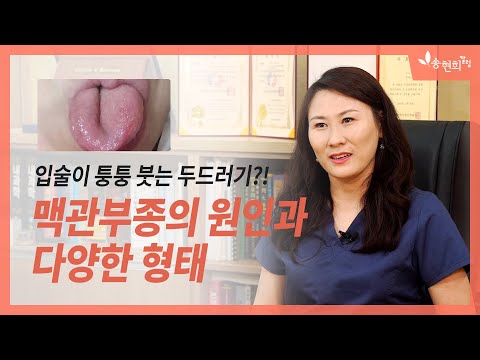 [자막]입술이 붓는 두드러기, 맥관부종(혈관부종)이란?