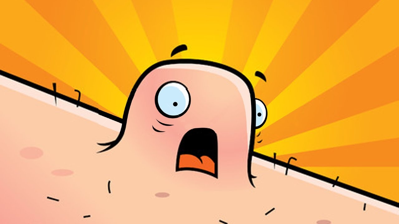 Best Wart Remover - How to Get Rid of a Wart in One Day - YouTube