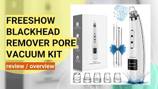 FREESHOW Blackhead Remover Review: Does This Pore Vacuum Really Work?